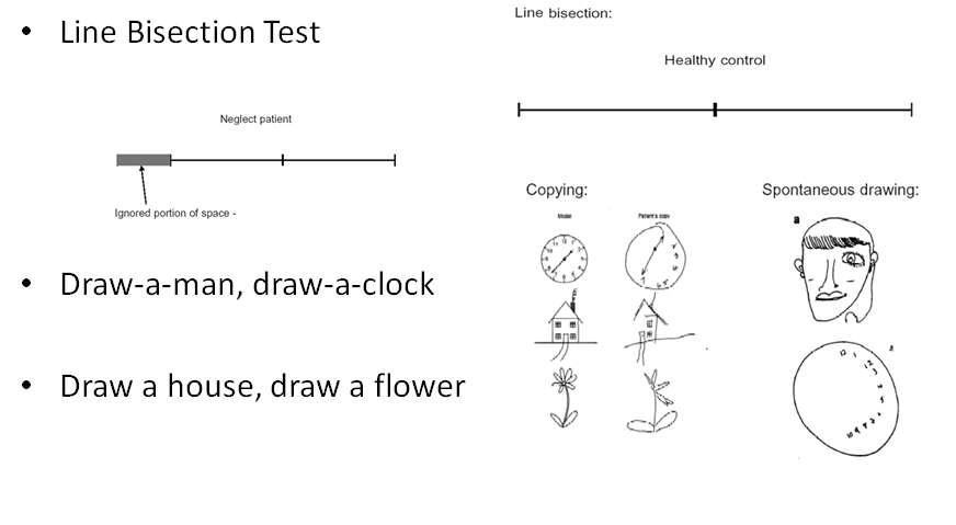 Inattention assessments